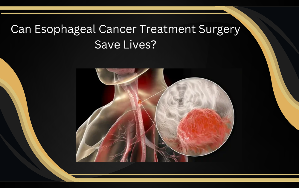 esophageal cancer treatment surgery